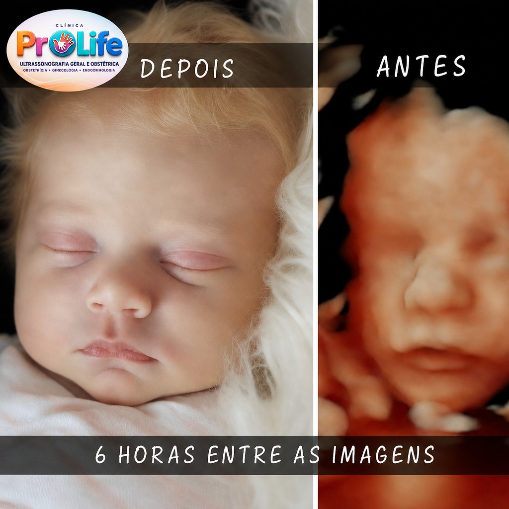 Gestante segurando a imagem do ultrassom do bebê